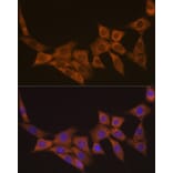 Immunofluorescence - Anti-Dcp1a Antibody [ARC1421] (A10006) - Antibodies.com