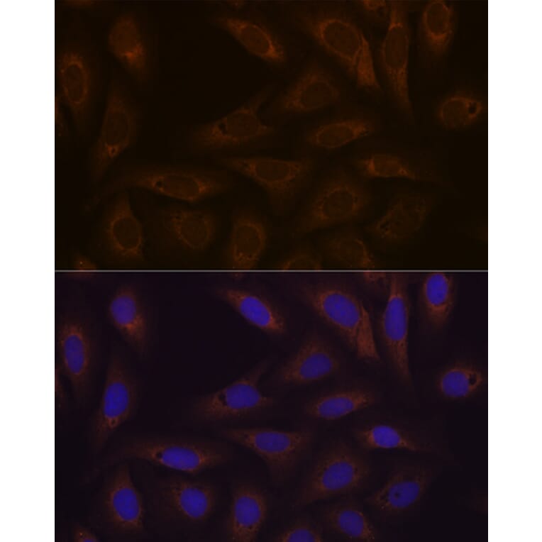 Immunofluorescence - Anti-Dcp1a Antibody [ARC1421] (A10006) - Antibodies.com