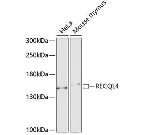 Western Blot - Anti-RECQL4 Antibody (A10010) - Antibodies.com