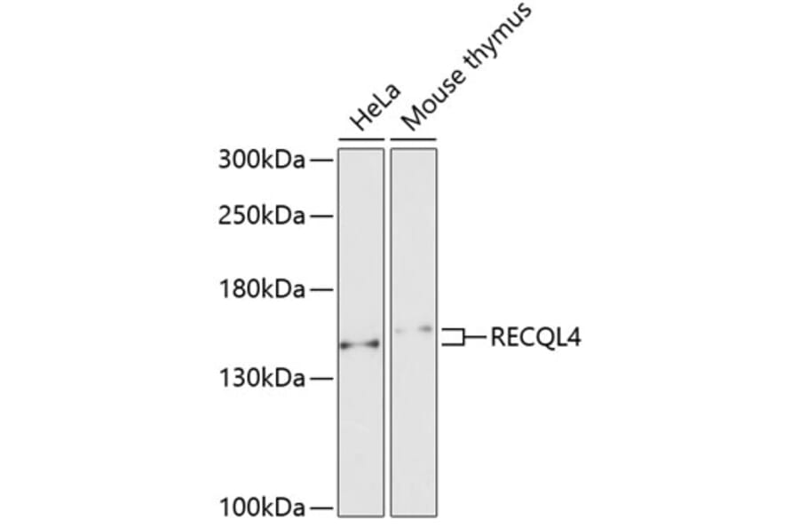 Western Blot - Anti-RECQL4 Antibody (A10010) - Antibodies.com