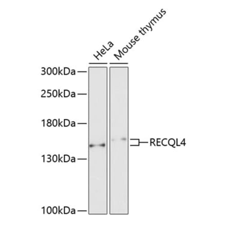 Western Blot - Anti-RECQL4 Antibody (A10010) - Antibodies.com