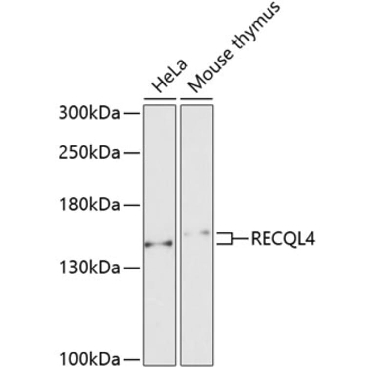 Western Blot - Anti-RECQL4 Antibody (A10010) - Antibodies.com