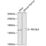 Western Blot - Anti-RECQL4 Antibody (A10010) - Antibodies.com