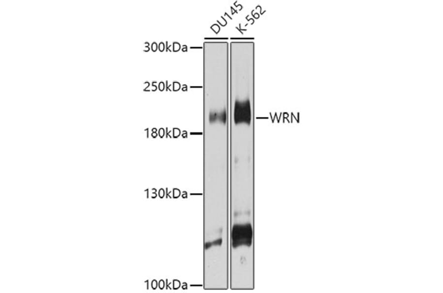 Western Blot - Anti-Werner's syndrome helicase WRN Antibody (A10013) - Antibodies.com
