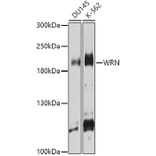 Western Blot - Anti-Werner's syndrome helicase WRN Antibody (A10013) - Antibodies.com