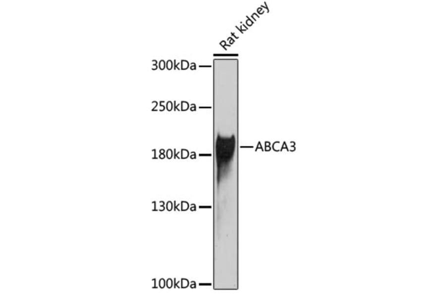 Western Blot - Anti-ATP-binding cassette sub-family A member 3 Antibody (A10016) - Antibodies.com