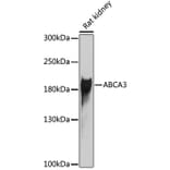 Western Blot - Anti-ATP-binding cassette sub-family A member 3 Antibody (A10016) - Antibodies.com