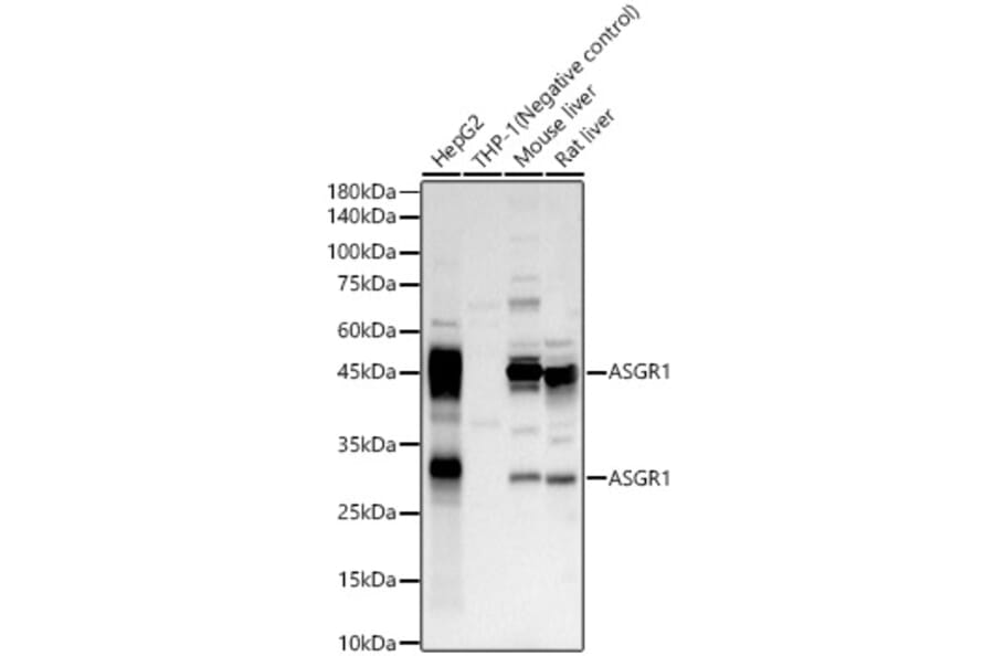Western Blot - Anti-Asialoglycoprotein Receptor 1/HL-1 Antibody (A10017) - Antibodies.com
