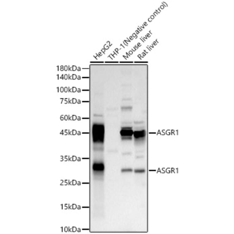 Western Blot - Anti-Asialoglycoprotein Receptor 1 / HL-1 Antibody (A10017) - Antibodies.com