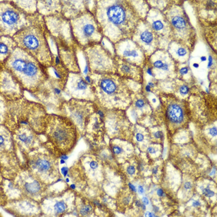 Immunohistochemistry - Anti-Asialoglycoprotein Receptor 1 / HL-1 Antibody (A10017) - Antibodies.com