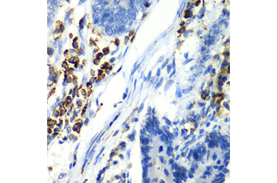 Immunohistochemistry - Anti-Asialoglycoprotein Receptor 1/HL-1 Antibody (A10017) - Antibodies.com