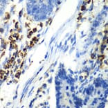 Immunohistochemistry - Anti-Asialoglycoprotein Receptor 1 / HL-1 Antibody (A10017) - Antibodies.com