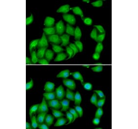 Immunofluorescence - Anti-Aspartate beta hydroxylase Antibody (A10018) - Antibodies.com