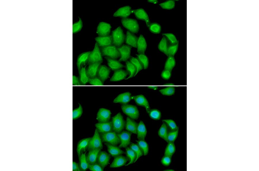 Immunofluorescence - Anti-Aspartate beta hydroxylase Antibody (A10018) - Antibodies.com