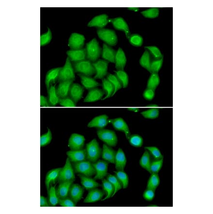 Immunofluorescence - Anti-Aspartate beta hydroxylase Antibody (A10018) - Antibodies.com