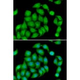 Immunofluorescence - Anti-Aspartate beta hydroxylase Antibody (A10018) - Antibodies.com
