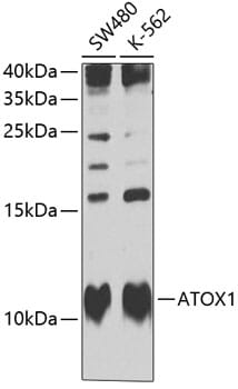 Western blot analysis of extracts of various cell lines, using Anti-ATOX1 Antibody (A6874) at 1:1,000 dilution.
Secondary antibody: Goat Anti-Rabbit IgG (H+L) (HRP) (AS014) at 1:10,000 dilution.
Lysates / proteins: 25µg per lane.
Blocking buffer: 3% non-fat dry milk in TBST.
Detection: ECL Basic Kit (RM00020).
Exposure time: 15s.