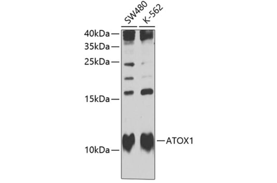 Western Blot - Anti-ATOX1 Antibody (A10019) - Antibodies.com