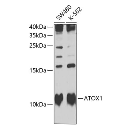 Western Blot - Anti-ATOX1 Antibody (A10019) - Antibodies.com
