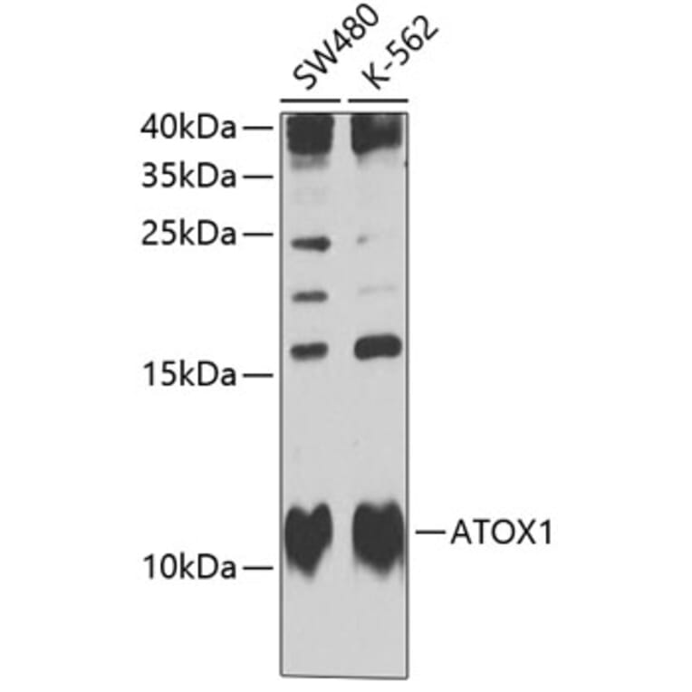 Western Blot - Anti-ATOX1 Antibody (A10019) - Antibodies.com