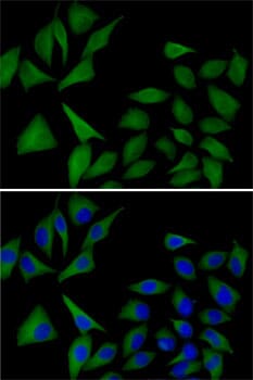 Immunofluorescence analysis of MCF7 cells using Anti-ATOX1 Antibody (A6874). Blue: DAPI for nuclear staining.