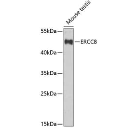 Western Blot - Anti-ERCC8 Antibody (A10020) - Antibodies.com