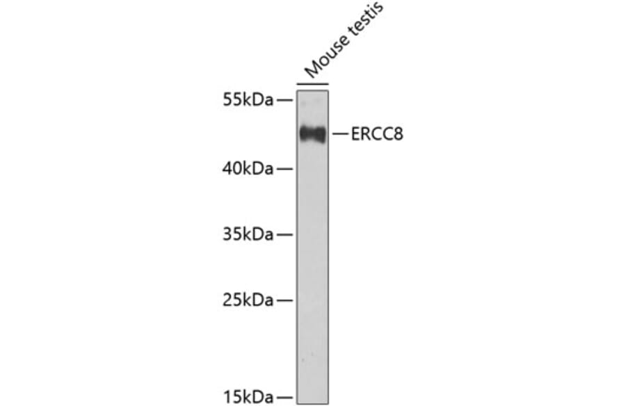 Western Blot - Anti-ERCC8 Antibody (A10020) - Antibodies.com