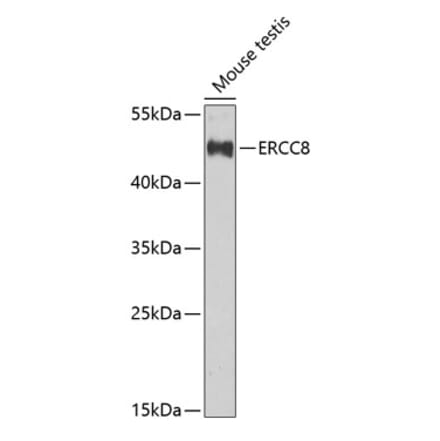 Western Blot - Anti-ERCC8 Antibody (A10020) - Antibodies.com