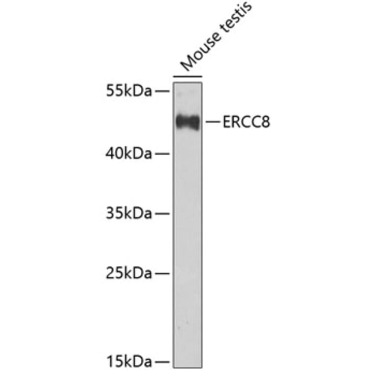 Western Blot - Anti-ERCC8 Antibody (A10020) - Antibodies.com