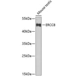 Western Blot - Anti-ERCC8 Antibody (A10020) - Antibodies.com