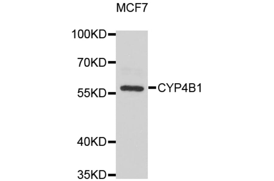 Western Blot - Anti-CYP4B1 Antibody (A6894) - Antibodies.com