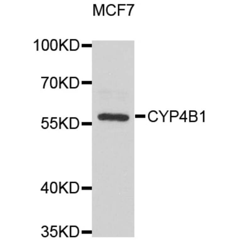 Western Blot - Anti-CYP4B1 Antibody (A6894) - Antibodies.com