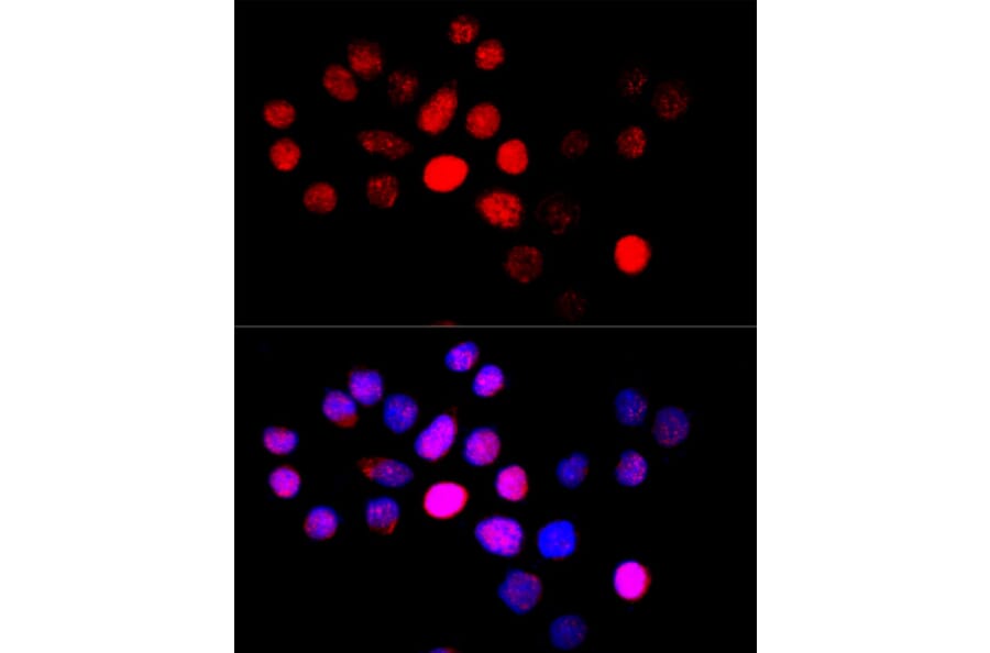 Immunofluorescence - Anti-CYP4B1 Antibody (A6894) - Antibodies.com