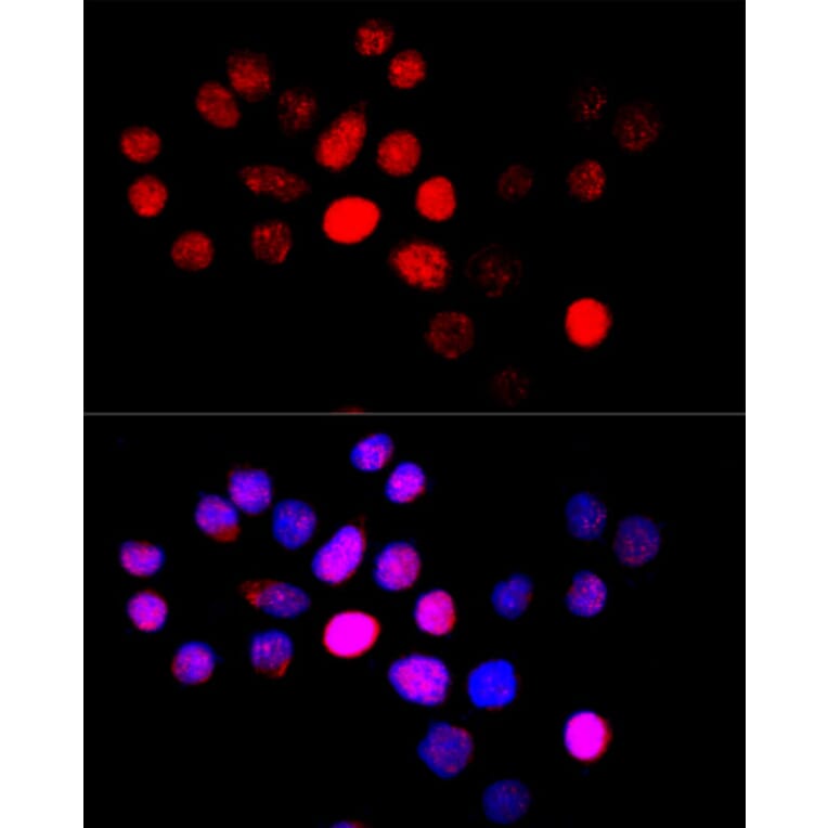 Immunofluorescence - Anti-CYP4B1 Antibody (A6894) - Antibodies.com