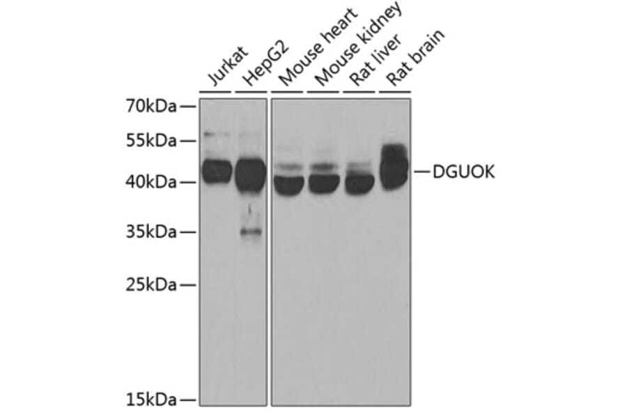 Western Blot - Anti-dGK Antibody (A10022) - Antibodies.com