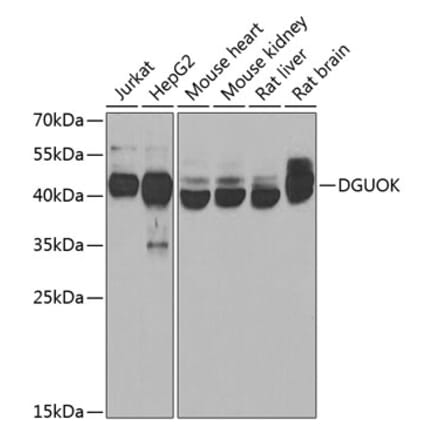 Western Blot - Anti-dGK Antibody (A10022) - Antibodies.com