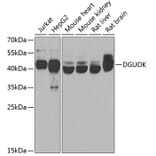 Western Blot - Anti-dGK Antibody (A10022) - Antibodies.com