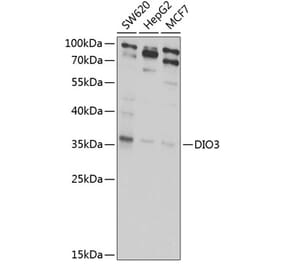 Western Blot - Anti-Dio3 Antibody (A10023) - Antibodies.com