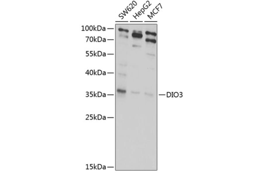 Western Blot - Anti-Dio3 Antibody (A10023) - Antibodies.com