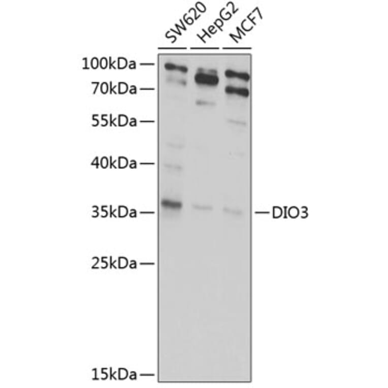 Western Blot - Anti-Dio3 Antibody (A10023) - Antibodies.com