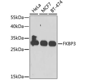 Western Blot - Anti-FKBP25 Antibody (A10024) - Antibodies.com