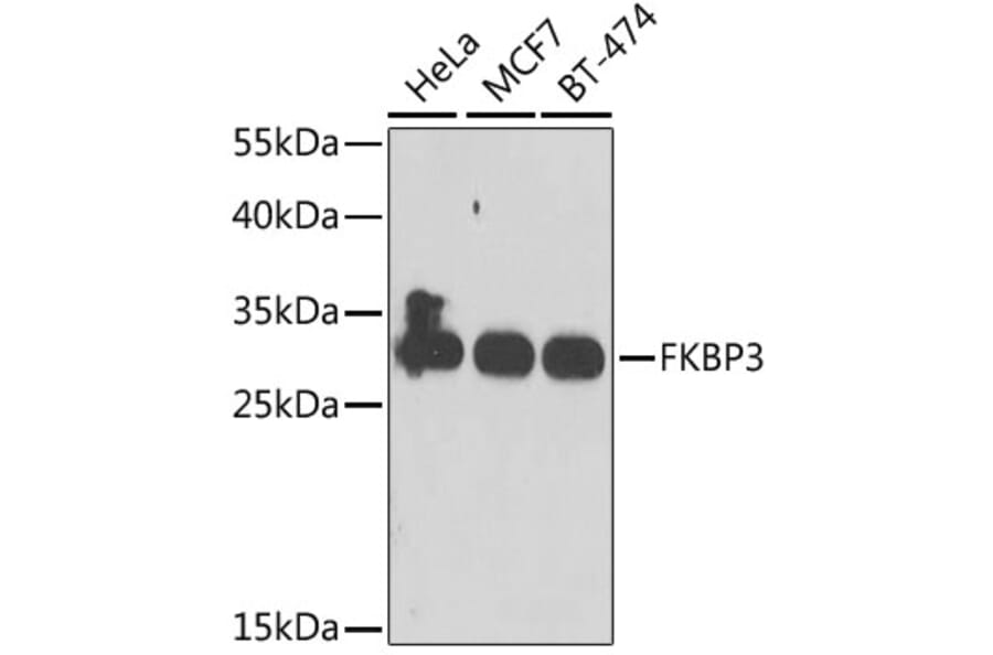 Western Blot - Anti-FKBP25 Antibody (A10024) - Antibodies.com