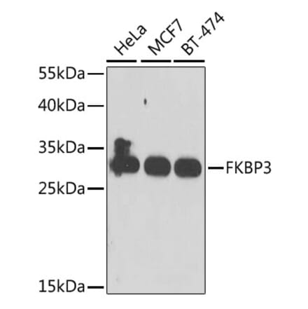 Western Blot - Anti-FKBP25 Antibody (A10024) - Antibodies.com