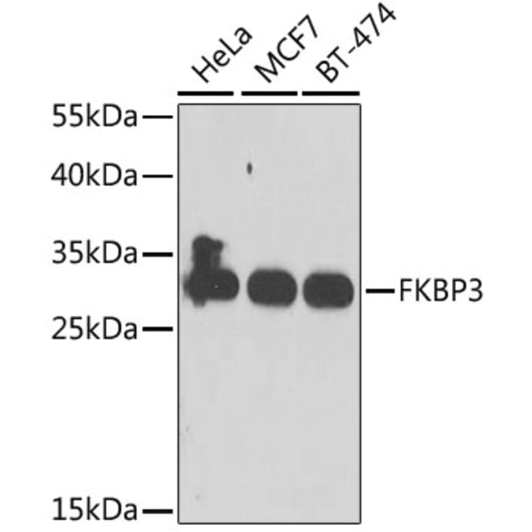 Western Blot - Anti-FKBP25 Antibody (A10024) - Antibodies.com