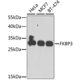 Western Blot - Anti-FKBP25 Antibody (A10024) - Antibodies.com