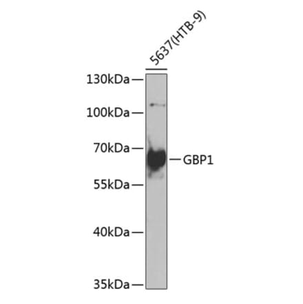 Western Blot - Anti-GBP1 Antibody (A10025) - Antibodies.com