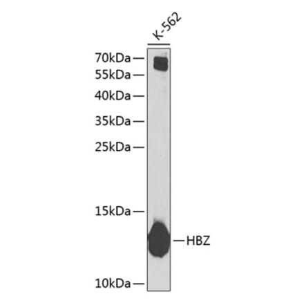 Western Blot - Anti-Hemoglobin subunit zeta Antibody (A10026) - Antibodies.com