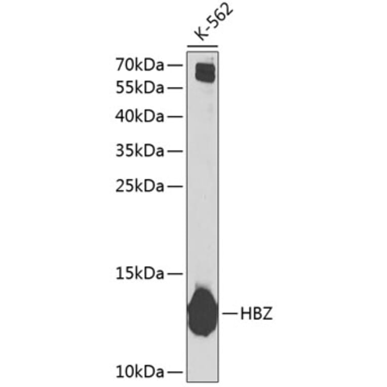 Western Blot - Anti-Hemoglobin subunit zeta Antibody (A10026) - Antibodies.com