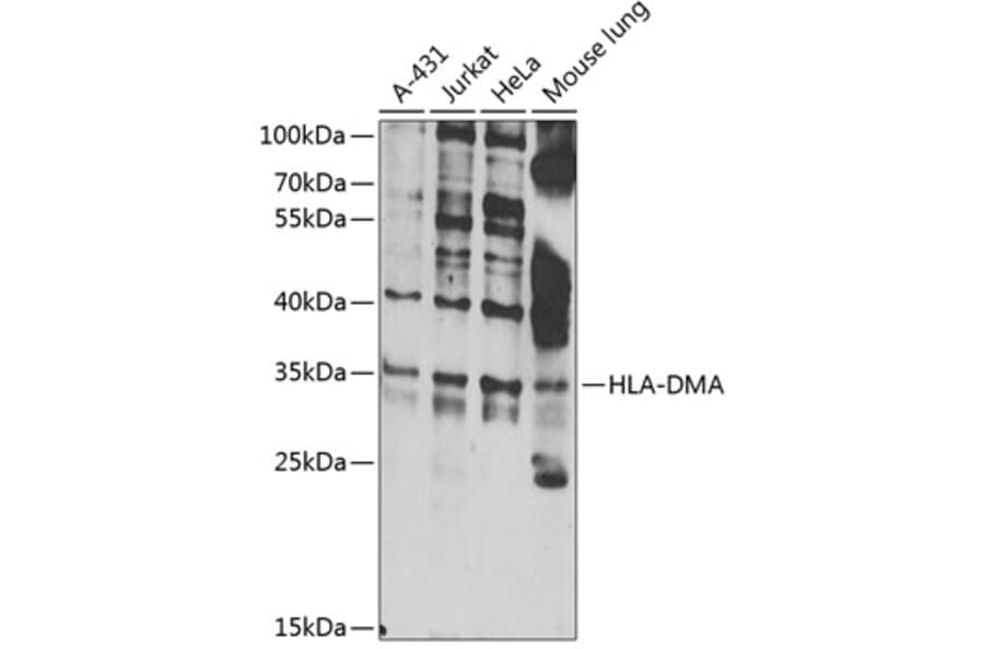 Western Blot - Anti-HLA DMA Antibody (A10027) - Antibodies.com