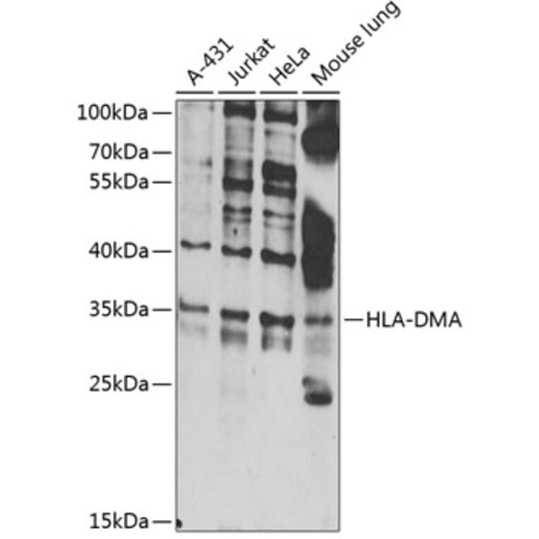 Western Blot - Anti-HLA DMA Antibody (A10027) - Antibodies.com